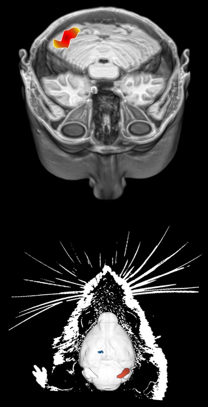 MRIs of a human brain and mouse brain